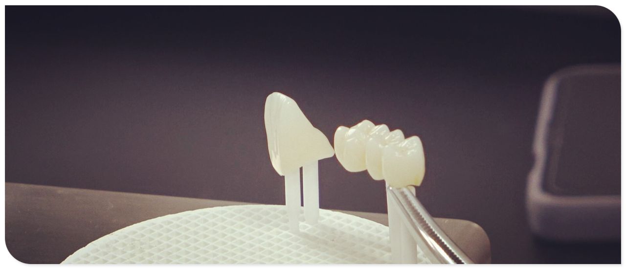 Challenges into the Use of Lithium Disilicate Blocks