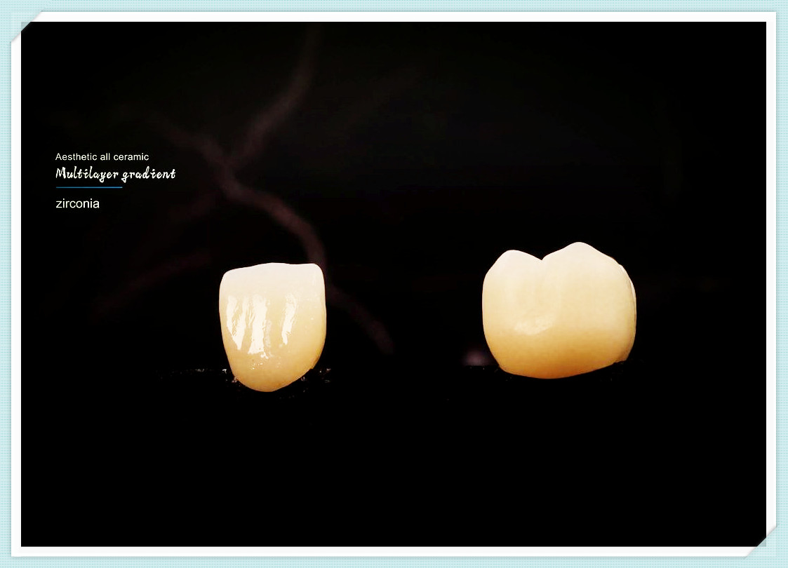Safety of Dental Lab Components